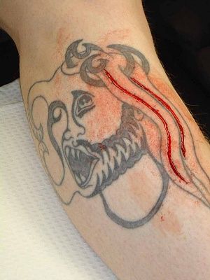 scar-blood.jpg