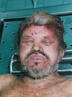 at%20the%20morgue%2094.jpg