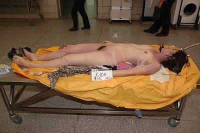 20091028043-inpainted.jpg