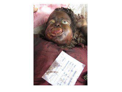 bloat-231.jpg