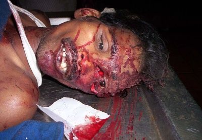 killed_in_car_accident_in_india1.jpg