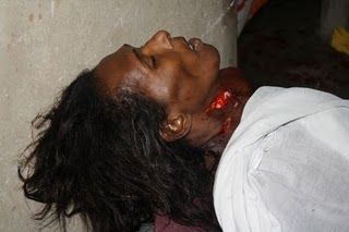 Name:  Corpse.jpg
Views: 51
Size:  14.6 KB
