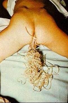 worm1.jpg