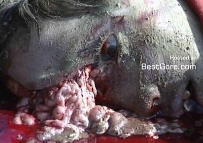 machete-wound-499x509.jpg