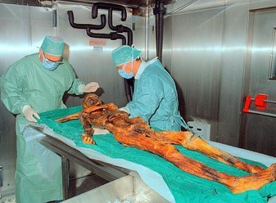 otzi-under-surgery.jpg