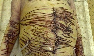 40050d1237774860-guy-cut-up-preety-bad-10.jpg