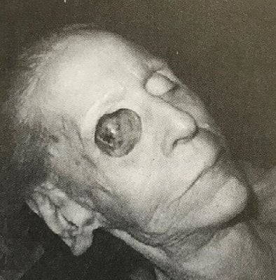 eye.jpg
