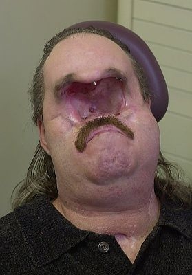 zygomycete-.jpg