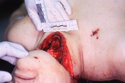 cut_my_neck_he_did_173.jpg