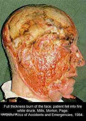 goregasm-dot-com-burn1.jpg
