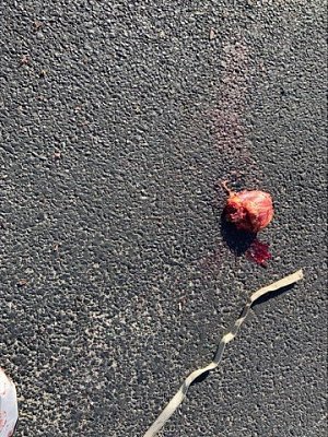 moto-20accident-20pic-202.jpg
