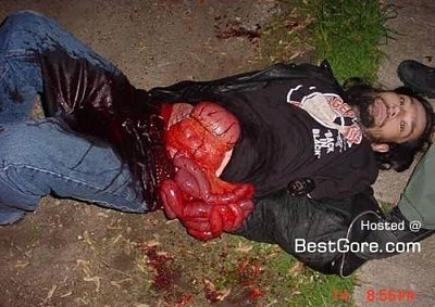 meth-addict-cut-guts-02-500x354.jpg