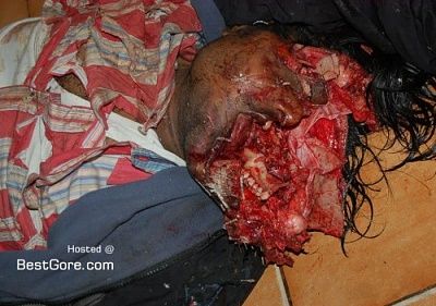 blunt-object-beaten-head-blasted-02-500x351.jpg