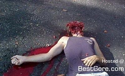 face-blown-off-firecracker-03.jpg