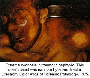 tcfor182.jpg