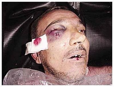 abu-20gharib-20csaction-2018-2006032009.jpg