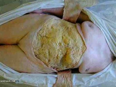 open-wide_fat.jpg