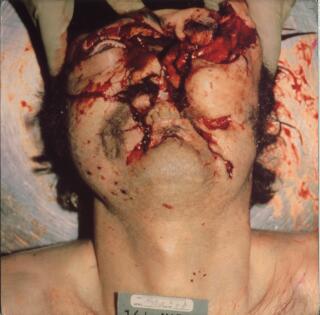 headache13.jpg