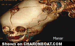 charonboat_dot_com_parasitic_head_3.jpg