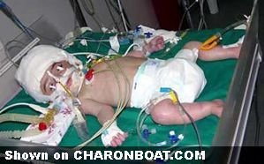 charonboat_dot_com_parasitic_head_4.jpg