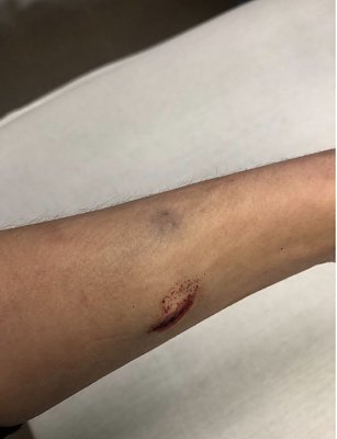blood2.jpg