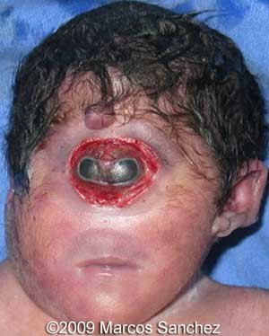 Holoprosen_Sanchez7.jpg