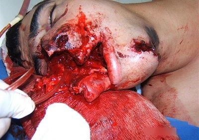 failed-suicide-brazilian-soldier-gore-04.jpg