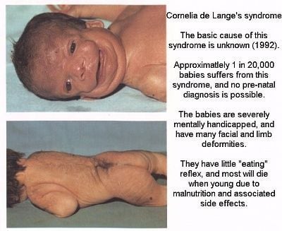 babycdl.jpg