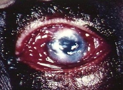 pseudomonas-ulcer.jpg