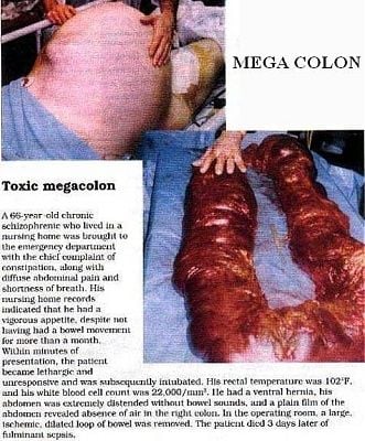 megashit.jpg