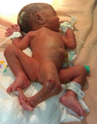 babypoo2.jpg