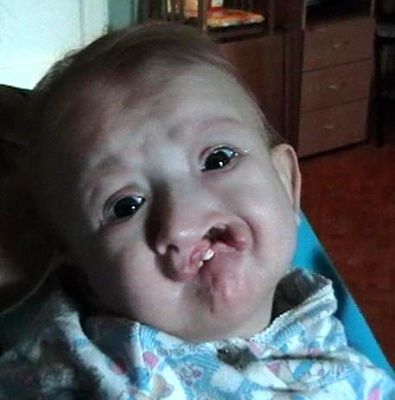deformities-3.jpg