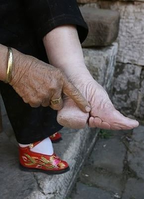 foot-20binding-201.jpg
