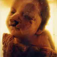 foetuswithbirthdefects.jpg