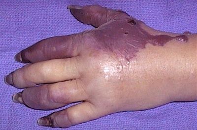 skin185.jpg
