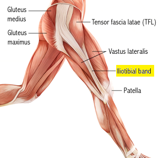 it-band.png
