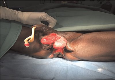 nigerianjplastsurg_2020_16_2_65_303833_f1.jpg