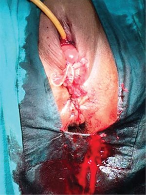 nigerianjplastsurg_2019_15_1_24_265407_f1.jpg