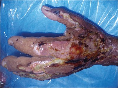 nigerianjplastsurg_2016_12_1_17_193735_u1.jpg