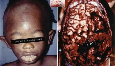 brain-smasher_niglet.jpg