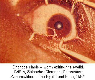 festered_eyes034.jpg