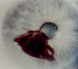 blood%20on%20the%20eye.gif