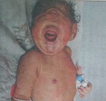 cyclopianchildchennai.jpg
