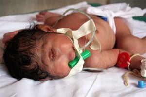 cyclopsbaby.jpg