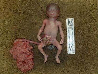 aborted.jpg
