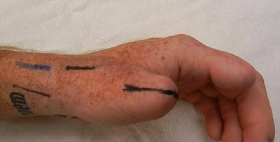 thumb1.jpg