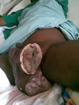 13370-most-fucked-up-balls-planetbig0.jpg