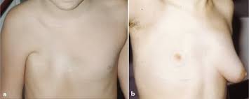 images.jpeg