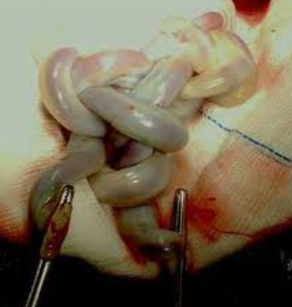 umbilical%20cord.png