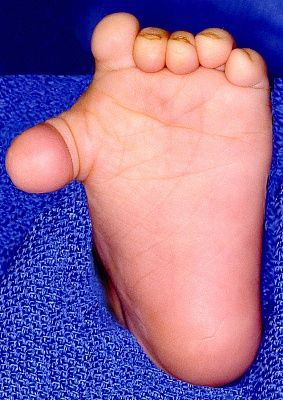 1230552-1258400-1260255-1260320.jpg
